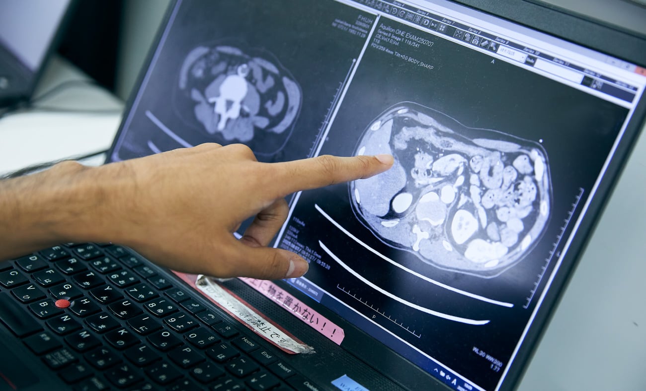 ER部門 助教 植田 秀樹